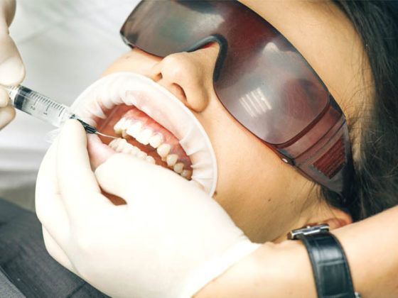 es recomendable realizar un blanqueamiento dental despues de la ortodoncia en nuestra clinica dental en Gijón Beatriz Vega