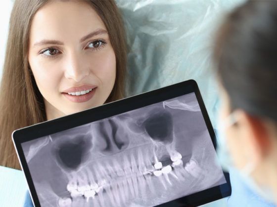 Las impresiones digitales son la alternativa moderna a los moldes tradicionales. Gracias a la digitalización y cirugía guiada, nuestros implantes dentales en Gijón tiene una altísima tasa de éxito